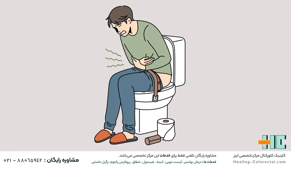 شقاق یا فیشر چگونه بوجود میآید؟