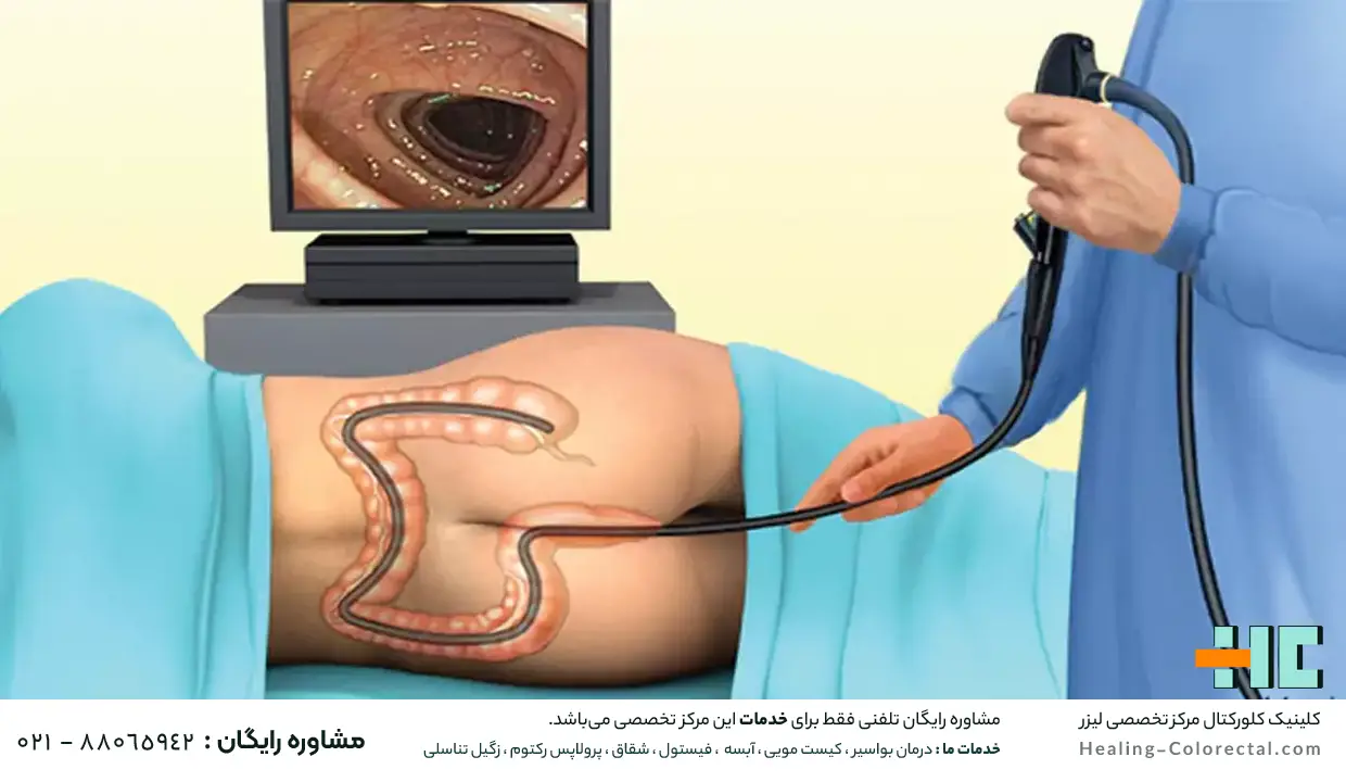 مراقبت بعد از کولونوسکوپی چرا مهم است؟