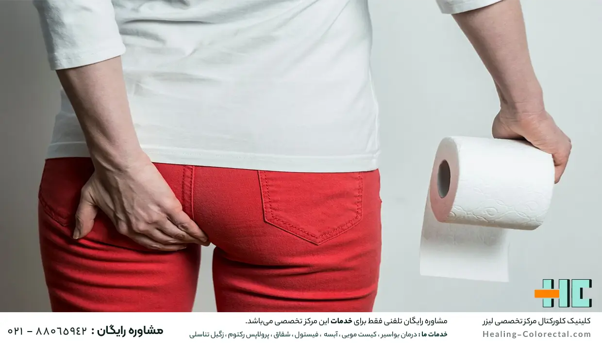 علائم بواسیر در زنان