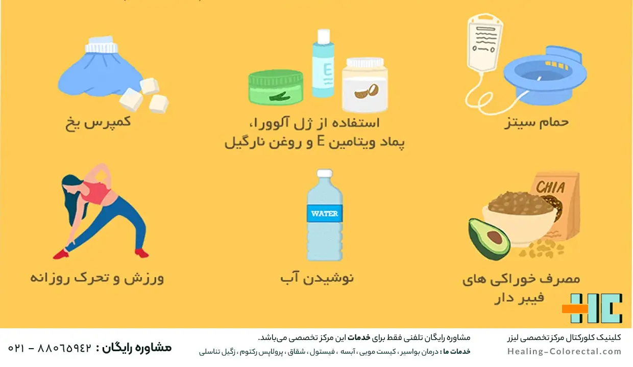 درمان بواسیر در زنان