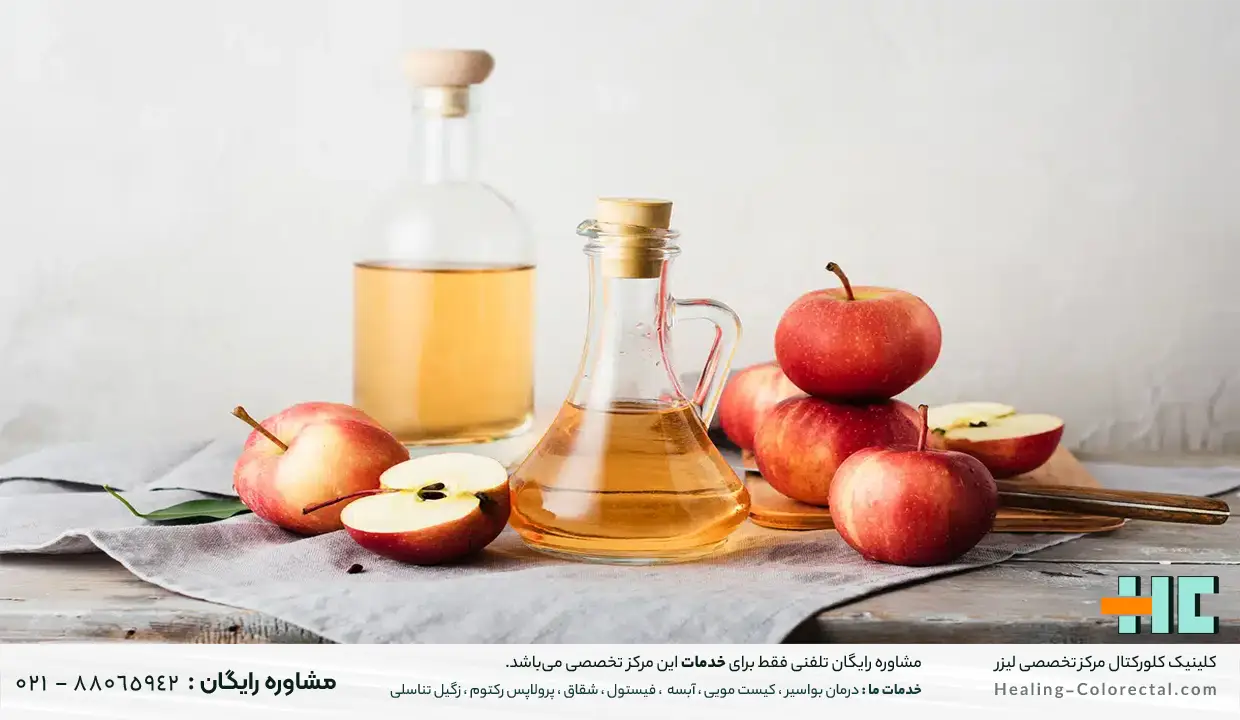 سرکه سیب برای درمان خانگی خارش زگیل مقعدی