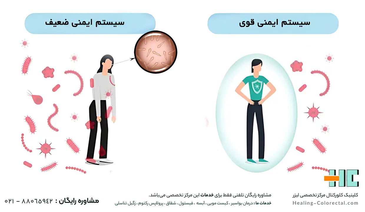 علت بوجود آمدن فیستول مقعدی