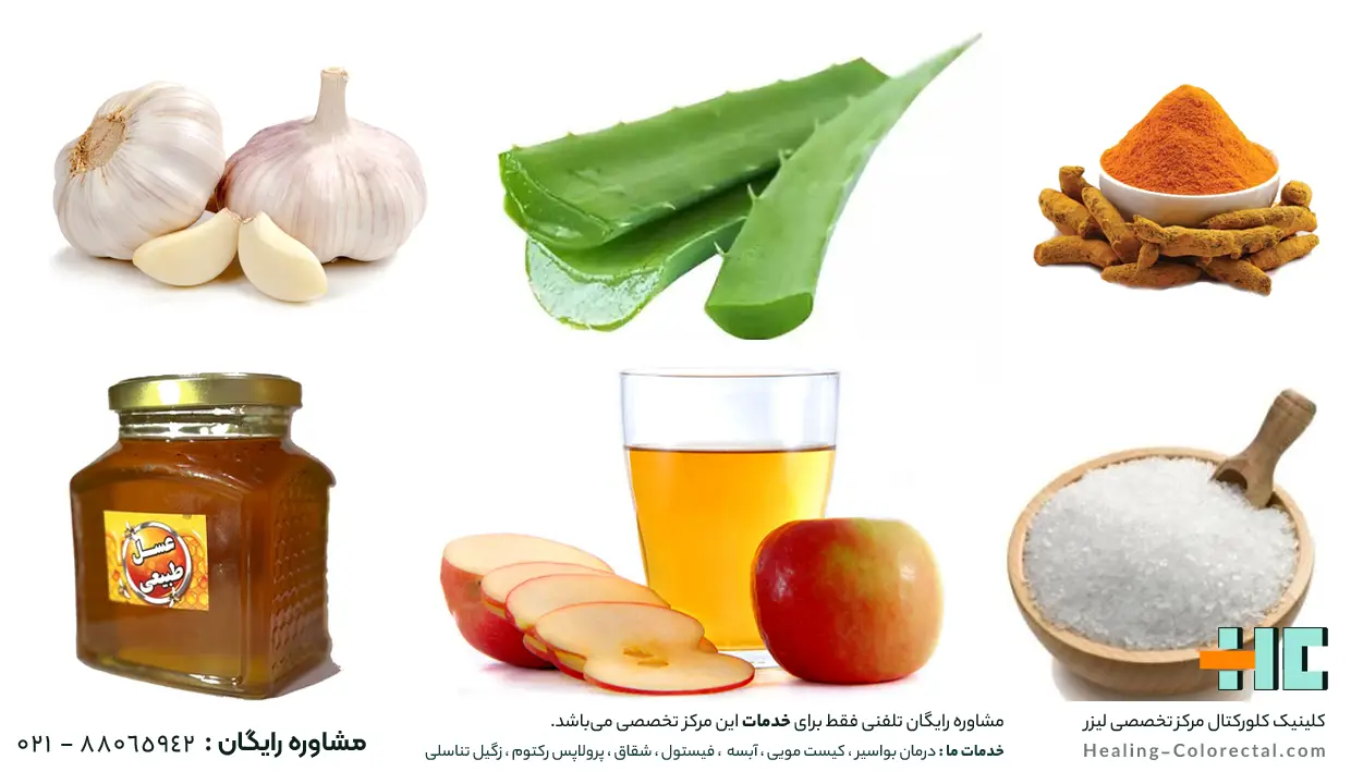 درمان خانگی کیست مویی