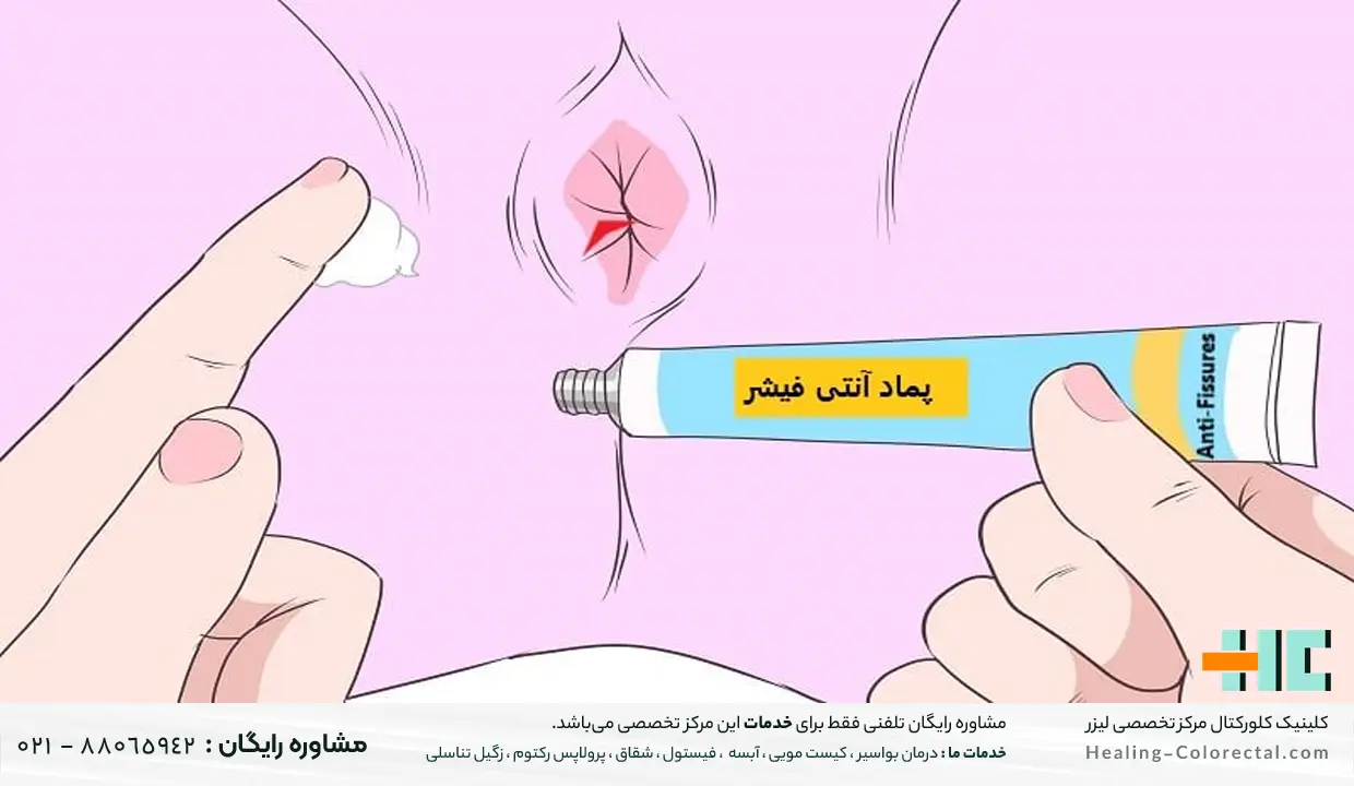 پماد تتراسایکلین برای شقاق مقعدی