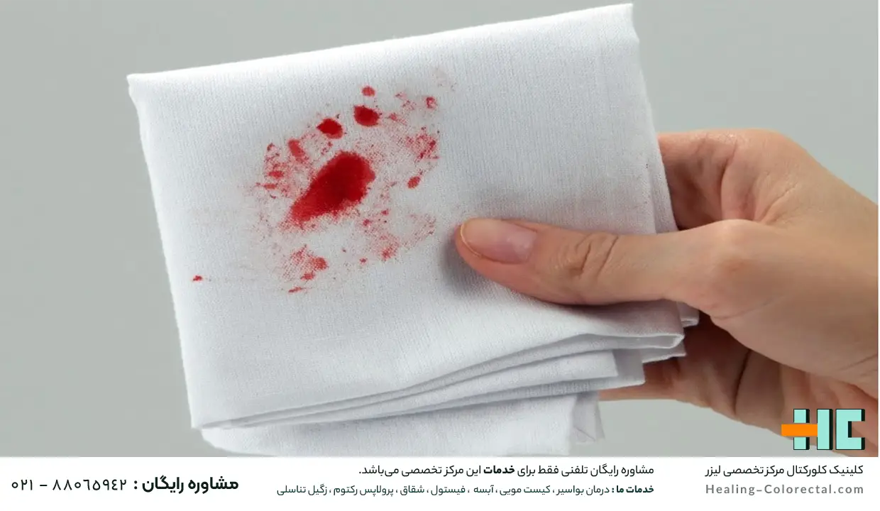 معایب جراحی سنتی هموروئید