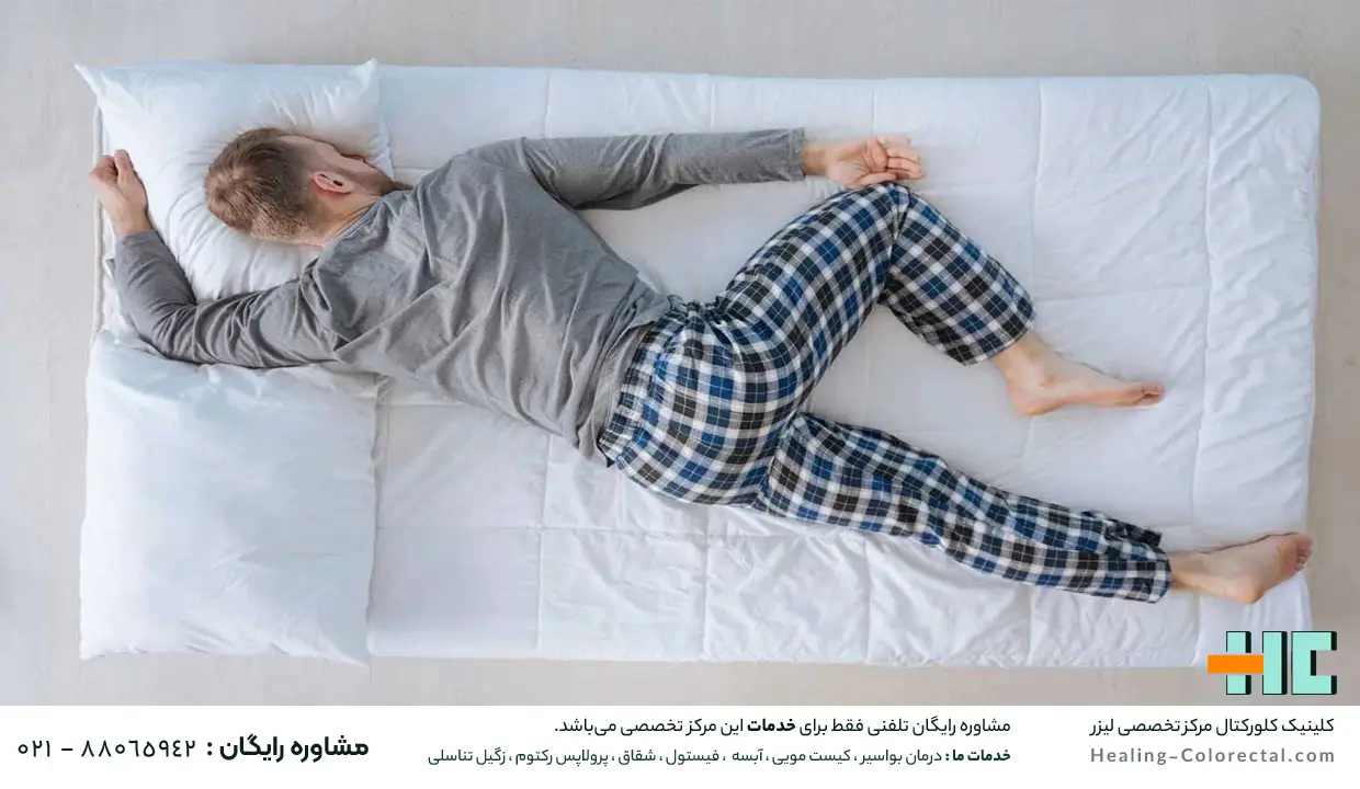 مراقبت بعد از درمان آبسه مقعدی جهت عدم بازگشت مجدد عارضه 