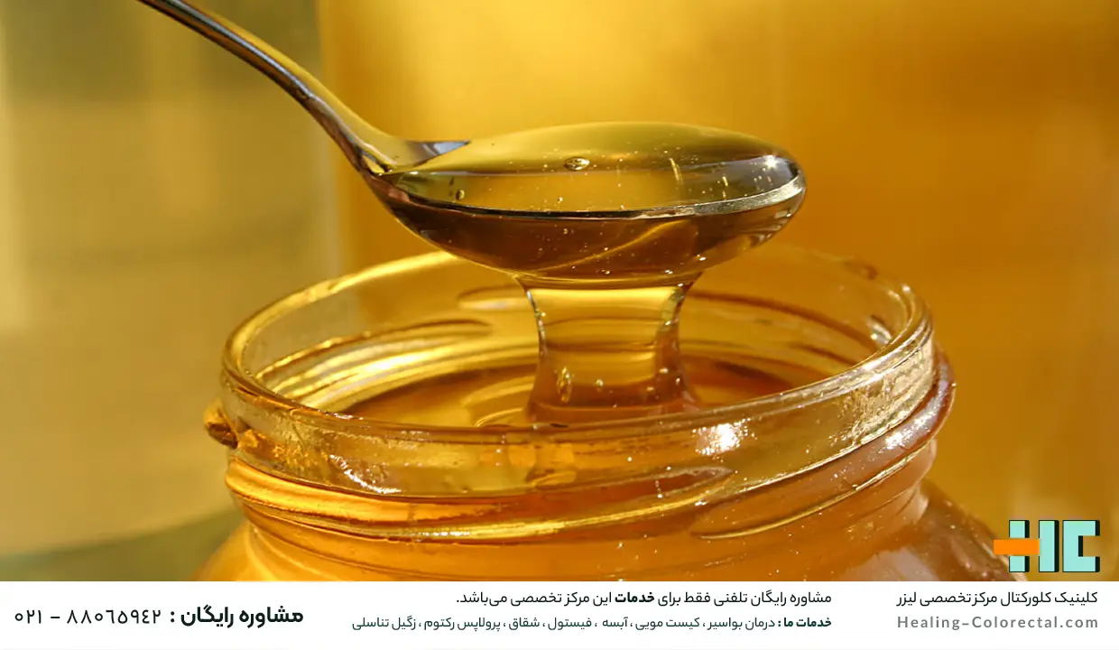 درمان هموروئید با عسل