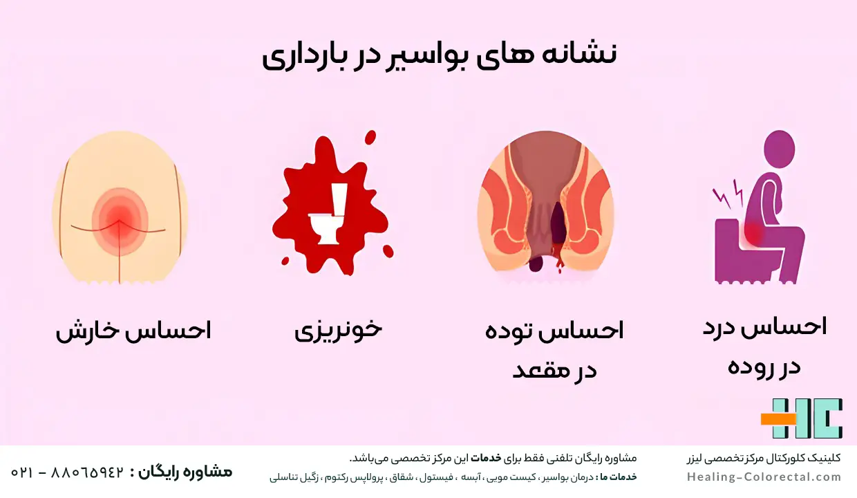 نشانه های بواسیر در بارداری