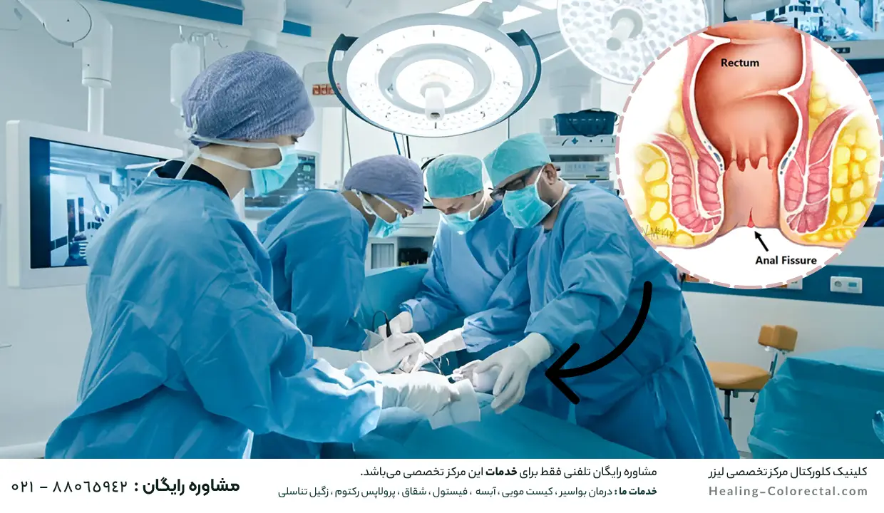 عمل شقاق در بارداری