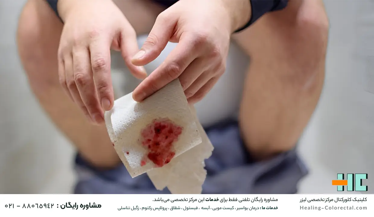 بواسیر خونی چیست؟