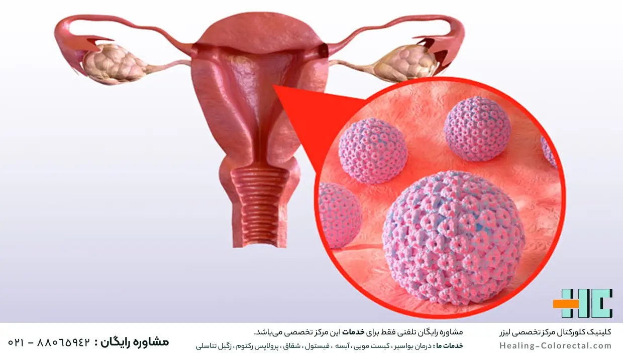 عملکرد واکسن گارداسیل بر بدن