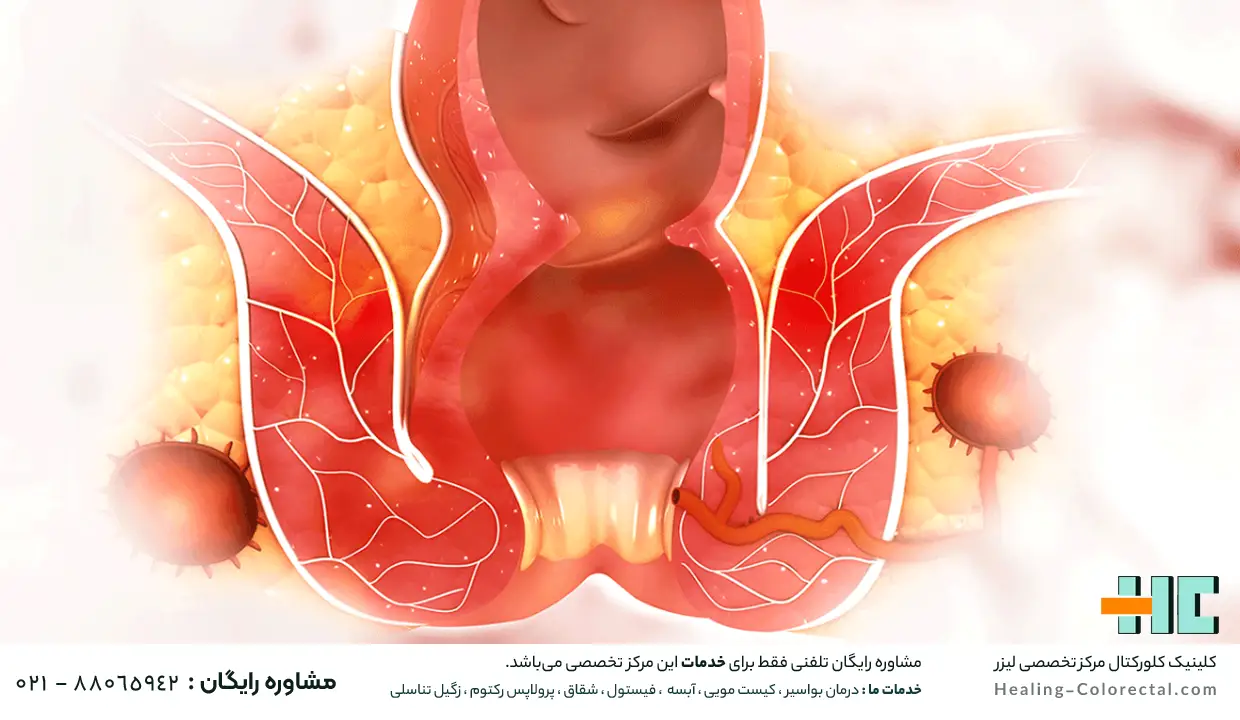 ویژگی های بهترین مرکز لیزر شقاق در تهران