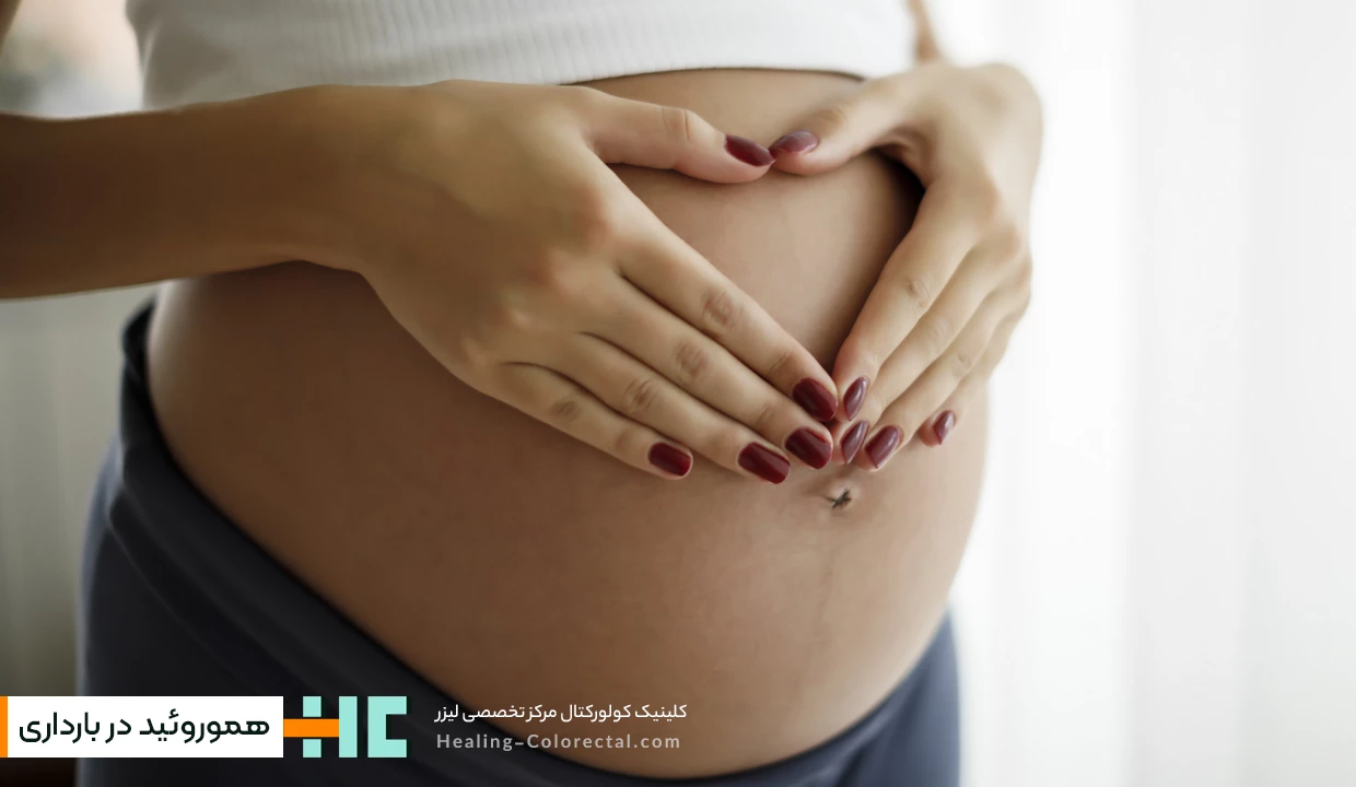 درمان هموروئید در بارداری