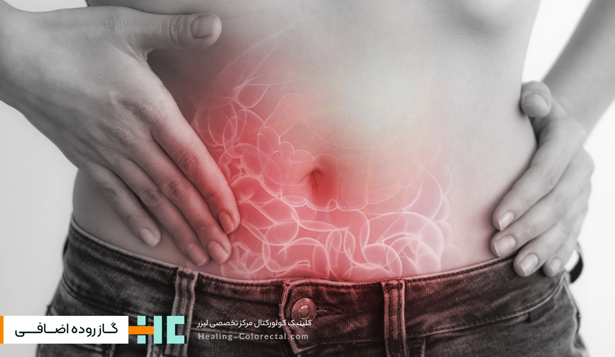 از بین بردن گاز روده